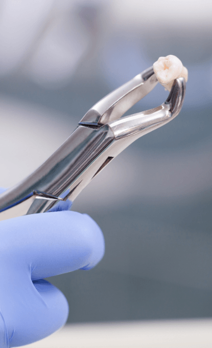 Metal clasp holding an extracted tooth