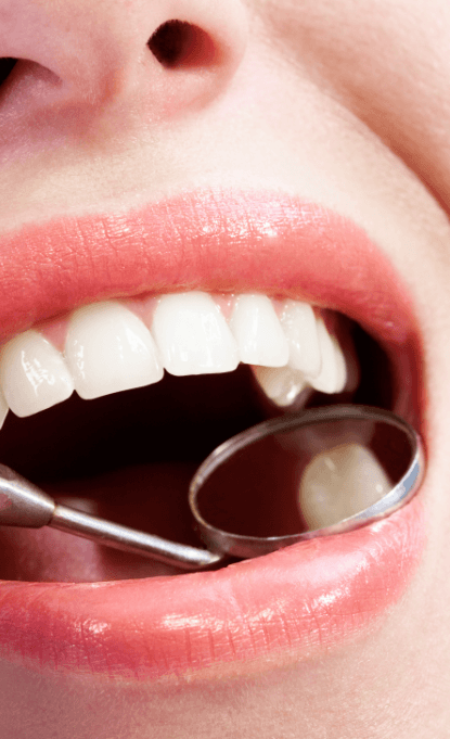 Closeup of smile during tooth colored fillings