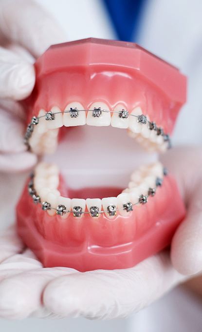 dentist holding model teeth with traditional braces in Denver