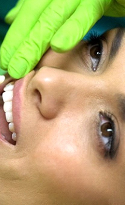 cosmetic dentist in Denver placing a veneer onto a patient’s tooth