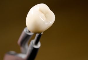 All-ceramic crown in dental lab