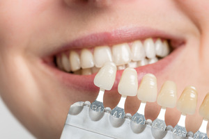 patient’s teeth being compared to a shade guide